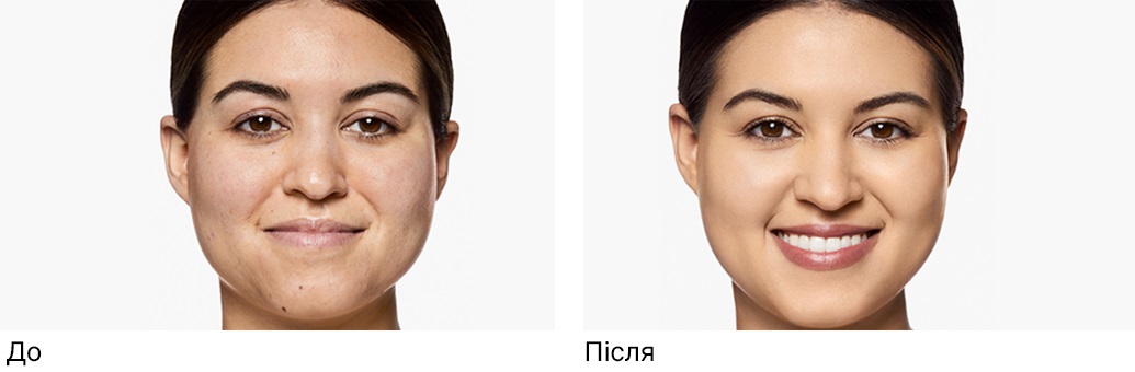 Clinique Foundations SP Before/After