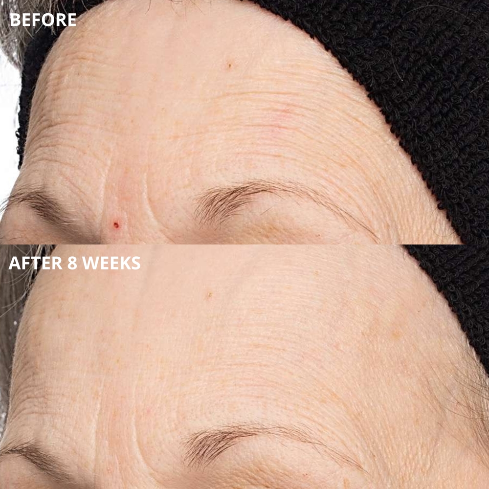 Perricone MD Cold Plasma Plus+ The Intensive Hydrating Complex ...