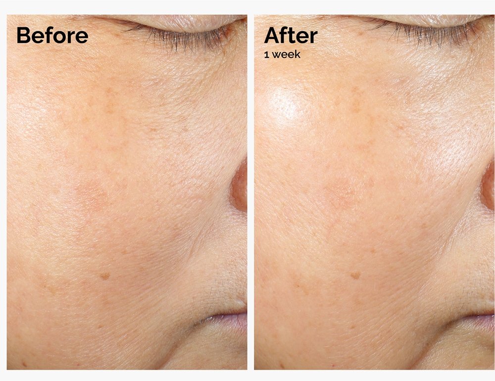 The Ordinary Rice The Ordinary Rice Lipids + Ectoin Microemulsion emulsão suave ...