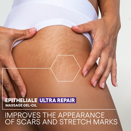 A-Derma Epitheliale A.H. Duo Massage Gel-Oil Massaaži geel-õli armidele ja venitusarmidele