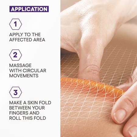 A-Derma Epitheliale A.H. Duo Massage Gel-Oil Massaaži geel-õli armidele ja venitusarmidele