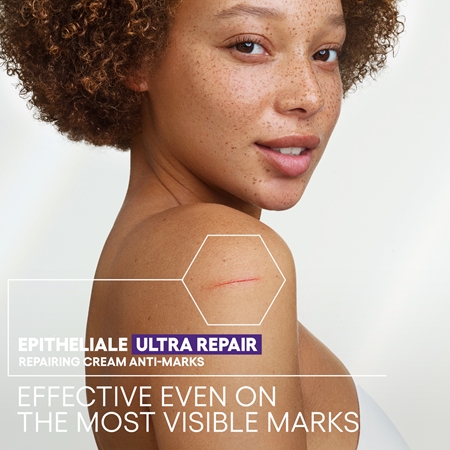 A-Derma Epitheliale A.H. Ultra Repair Repairing Cream Anti-Marks krem odnawiający do podrażnionej skóry