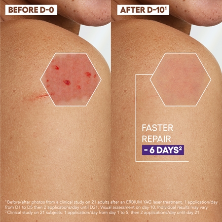 A-Derma Epitheliale A.H. Ultra Repair Repairing Cream Anti-Marks krem odnawiający do podrażnionej skóry