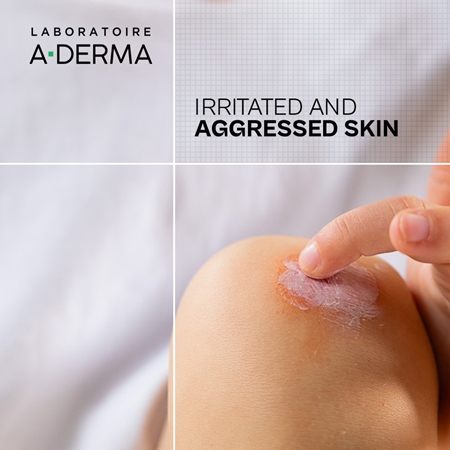 A-Derma Dermalibour+ Barrier raminamasis kremas odos apsaugai