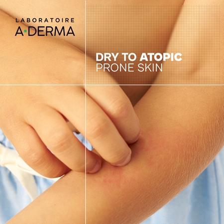 A-Derma Exomega Control Repairing Emollient Night Cream Regenerating Night Cream to stop scratching