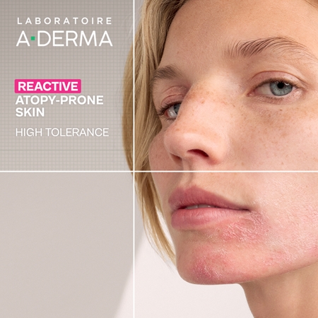 A-Derma Exomega Ultra-calming serum umirujući serum