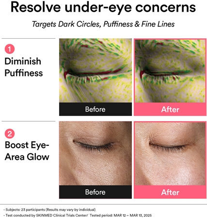 Abib PDRN Retinal Eye Patch Glow Jelly eye pads to treat wrinkles, puffiness and dark circles