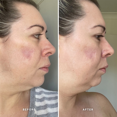 Alpha-H Vitamin A sérum s vitamínem A