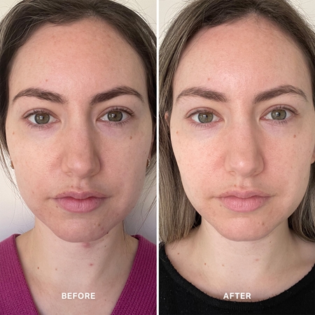 Alpha-H Vitamin B sérum pro posílení kožní bariéry