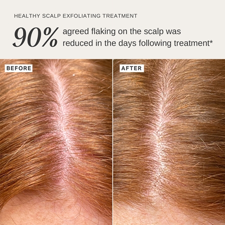 Alpha-H Healthy Scalp exfoliating solution for the head