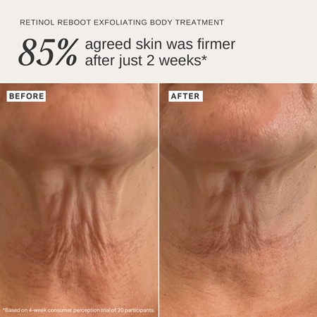Alpha-H Retinol Reboot feszesítő testápolás