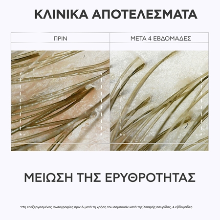 Apivita Dandruff Relief Oily Dandruff Dermatological Shampoo σαμπουάν κατά της πιτυρίδας για λιπαρά μαλλιά