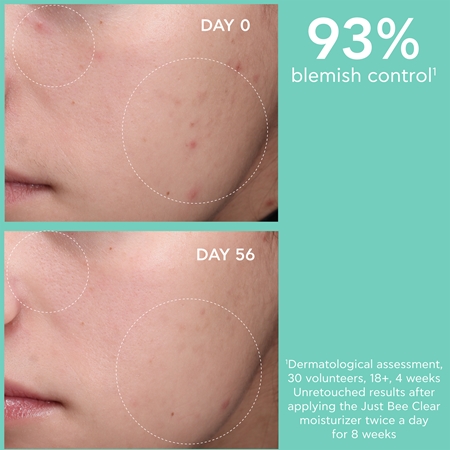 Apivita Just Bee Clear Blemish Control Moisturizer hydratační krém na obličej s niacinamidem