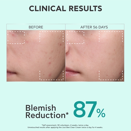 Apivita Just Bee Clear Blemish Control Moisturizer hydratačný krém na tvár s niacínamidom