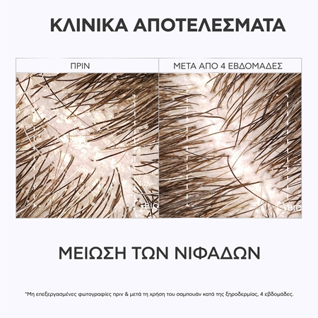 Apivita Dandruff Relief Dry Dandruff Dermatological Shampoo σαμπουάν κατά της πιτυρίδας για ξηρό και κνησμώδες δέρμα της κεφαλής