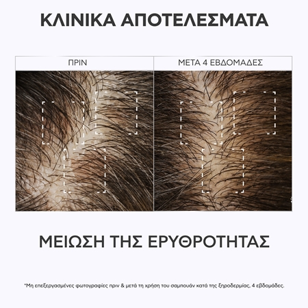 Apivita Dandruff Relief Dry Dandruff Dermatological Shampoo σαμπουάν κατά της πιτυρίδας για ξηρό και κνησμώδες δέρμα της κεφαλής