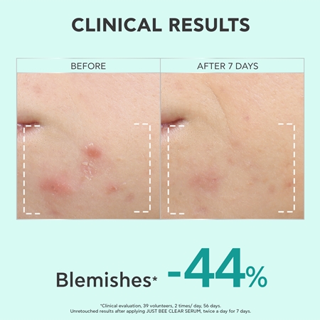 Apivita Just Bee Clear Serum serum for oily and problem skin
