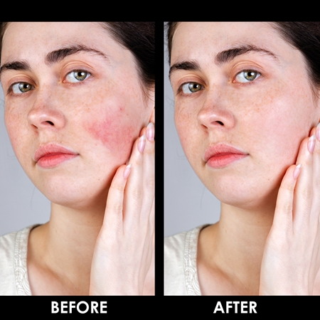 Arval Couperoll Anti-redness Night Cream & Mask naktinis kremas-kaukė jautriai ir paraudusiai odai