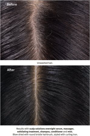 Aveda Scalp Solutions Exfoliating Scalp Treatment kuorintageeli päänahan uudistamiseen