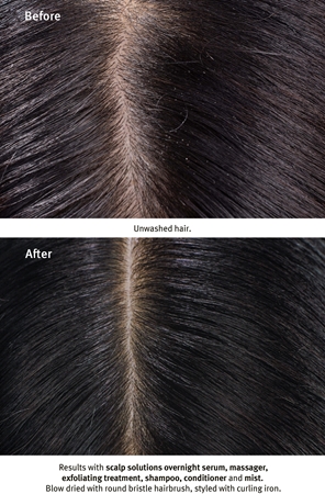 Aveda Scalp Solutions Exfoliating Scalp Treatment gel exfoliant pentru refacerea scalpului