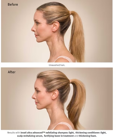 Aveda Invati Ultra Advanced™ Revitalizing Scalp Serum sérum renovador para cabello y cuero cabelludo