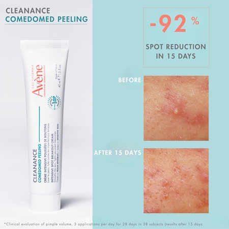 Avène Cleanance Comedomed intensyvaus poveikio kremas netobulumų turinčiai, į aknę linkusiai odai