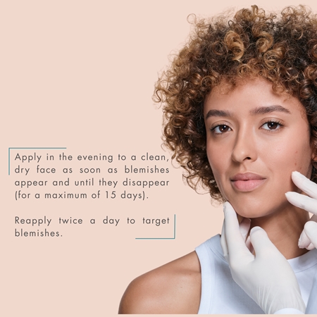 Avène Cleanance Comedomed Peeling crema intensiva para imperfecciones de la piel con acné