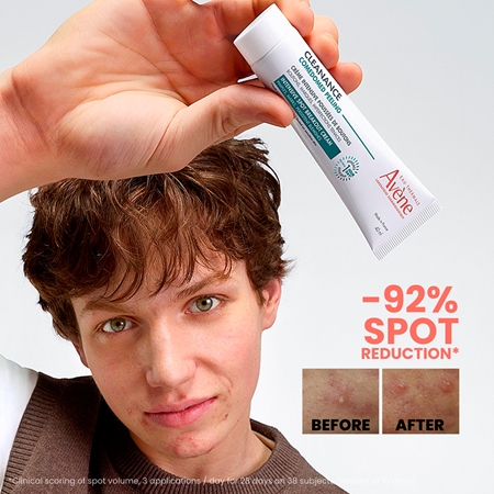 Avène Cleanance Comedomed Peeling crema intensa contro le imperfezioni della pelle acneica