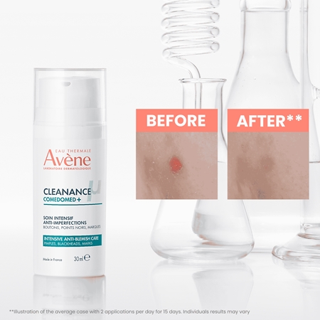 Avène Cleanance Comedomed+ intensyvaus poveikio priežiūros priemonė netobulumų turinčiai, į aknę linkusiai odai