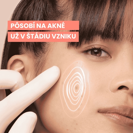 Avène Cleanance Comedomed+ intenzívna starostlivosť proti nedokonalostiam aknóznej pleti