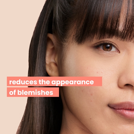 Avène Cleanance Comedomed Gel Peeling gel detergente esfoliante per pelli grasse e problematiche