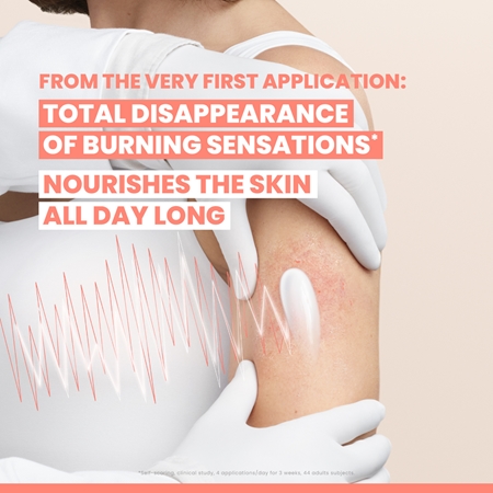 Avène XeraCalm A.D. Soothing Concentrate Calming Care to treat irritation and itching