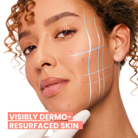 Avène Cleanance Comedomed Intensive Serum against imperfections in acne-prone skin
