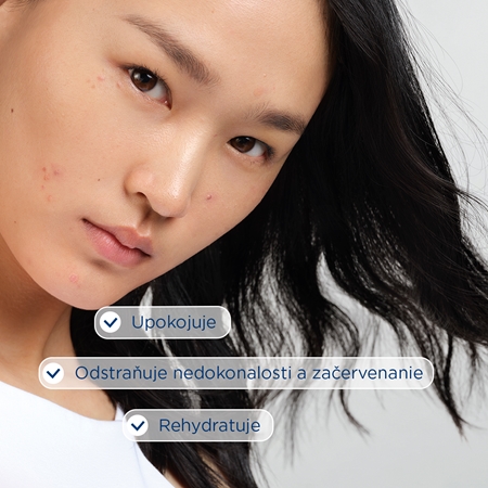 Bioderma Sébium Sensitive intenzívne hydratačný a upokojujúci krém pre pleť vysušenú a podráždenú liečbou akné