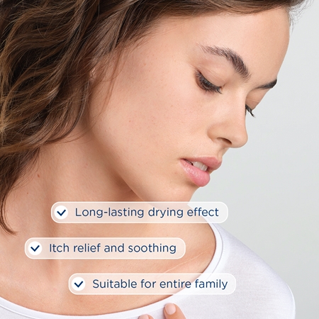 Bioderma Cicabio Lotion Spray Drying and Soothing Spray for irritated skin