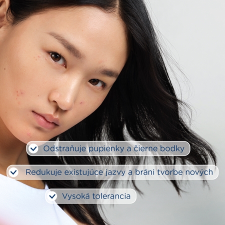 Bioderma Sébium Kerato+ gélový krém proti nedokonalostiam aknóznej pleti