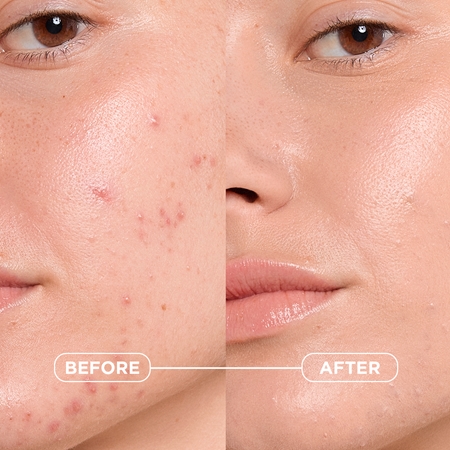 Bioderma Sébium Kerato+ Cover Mattifying Tinted Moisturiser against imperfections in acne-prone skin