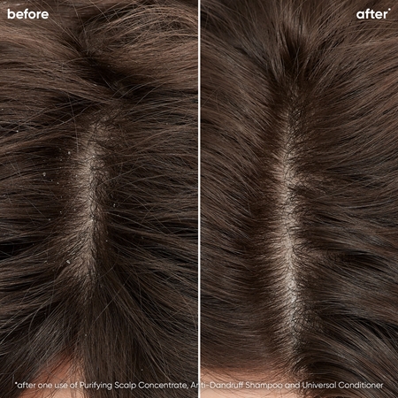 Biolage ScalpSync sampon korpásodás ellen