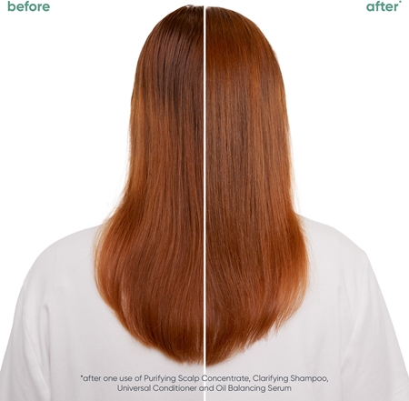 Biolage ScalpSync sérum capilar sérum de cabelo para cabelo oleoso