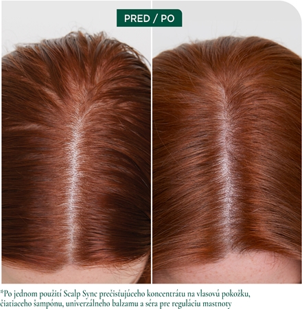 Biolage ScalpSync vlasové sérum na mastné vlasy