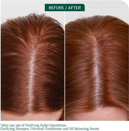 Biolage ScalpSync tisztító sampon