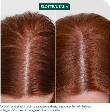Biolage ScalpSync tisztító sampon