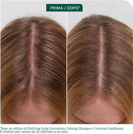 Biolage ScalpSync shampoo lenitivo