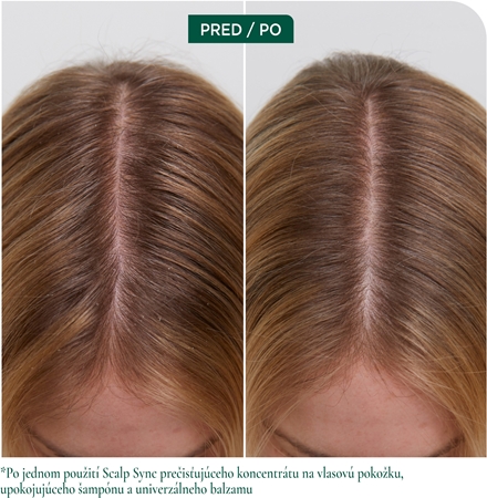 Biolage ScalpSync upokojujúci šampón