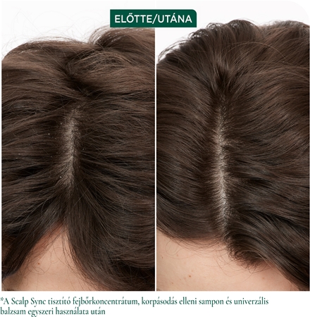 Biolage ScalpSync finom kondicionáló
