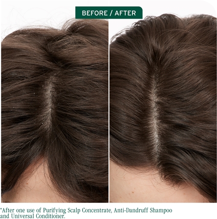 Biolage ScalpSync šampon proti lupům