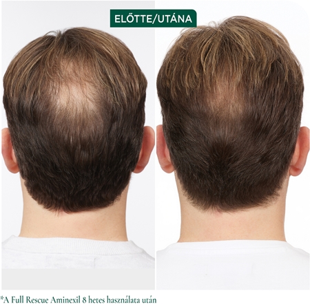 Biolage Full Rescue célzott ápolás hajhullás ellen
