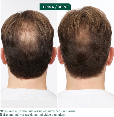 Biolage Full Rescue trattamento mirato anticaduta dei capelli