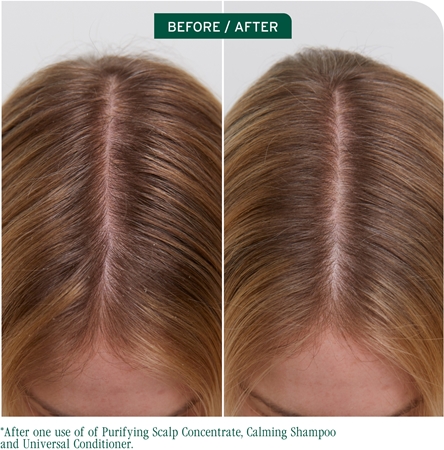Biolage ScalpSync koncentrátum fejbőrre