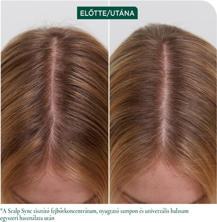 Biolage ScalpSync koncentrátum fejbőrre
